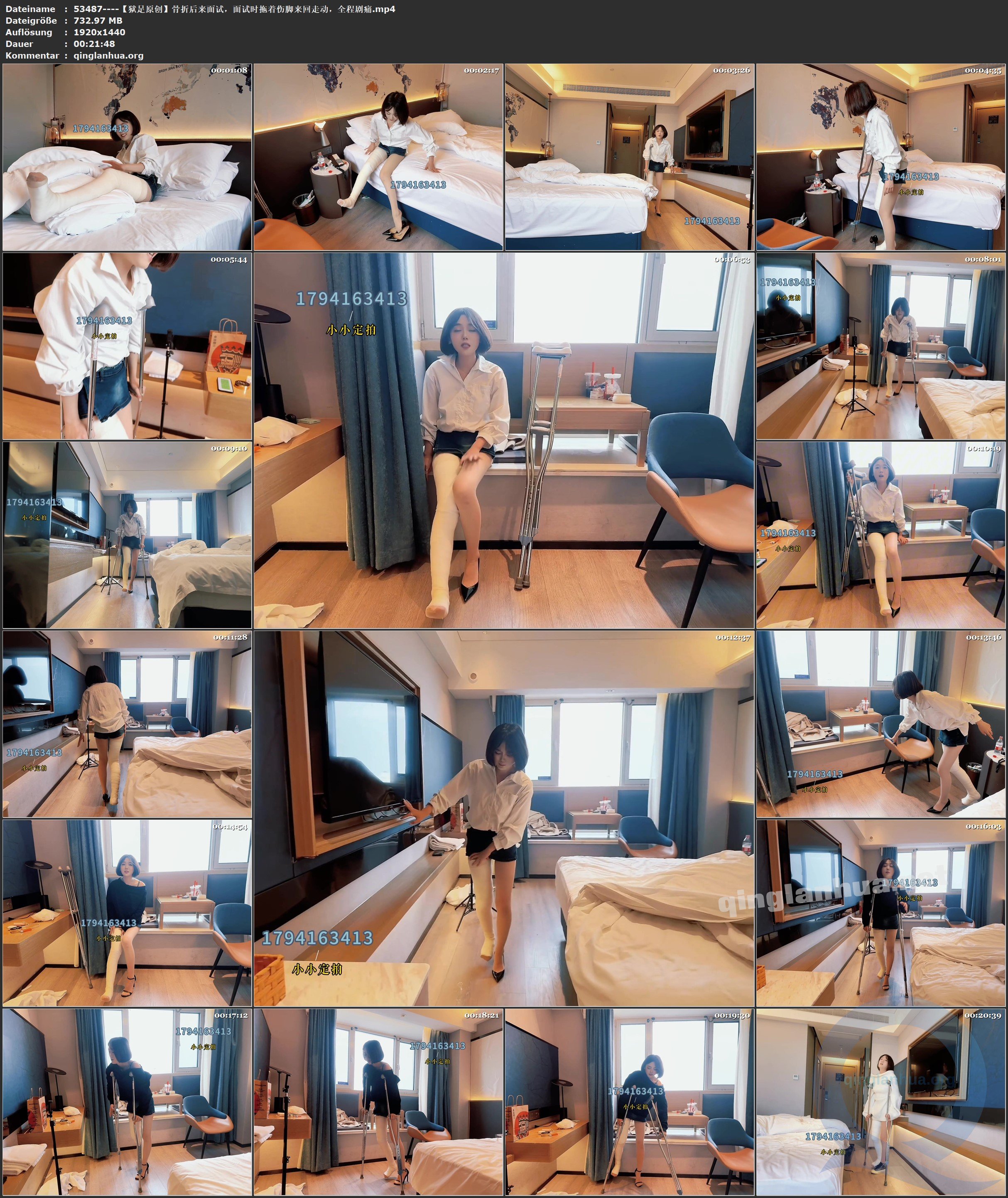 53487----【狱足原创】骨折后来面试，面试时拖着伤脚来回走动，全程剧痛.jpg